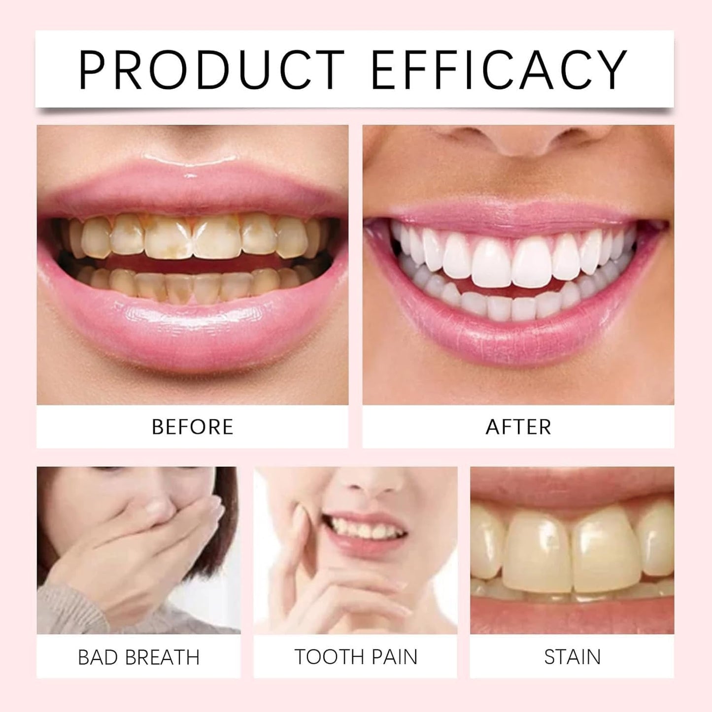 Dentifrice blanchissant à la niacinamide
