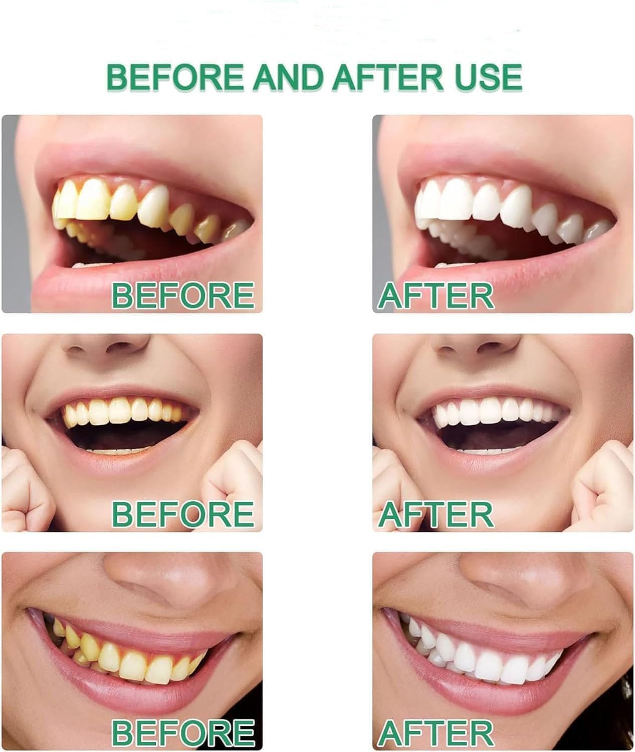 Dentifrice blanchissant à la niacinamide