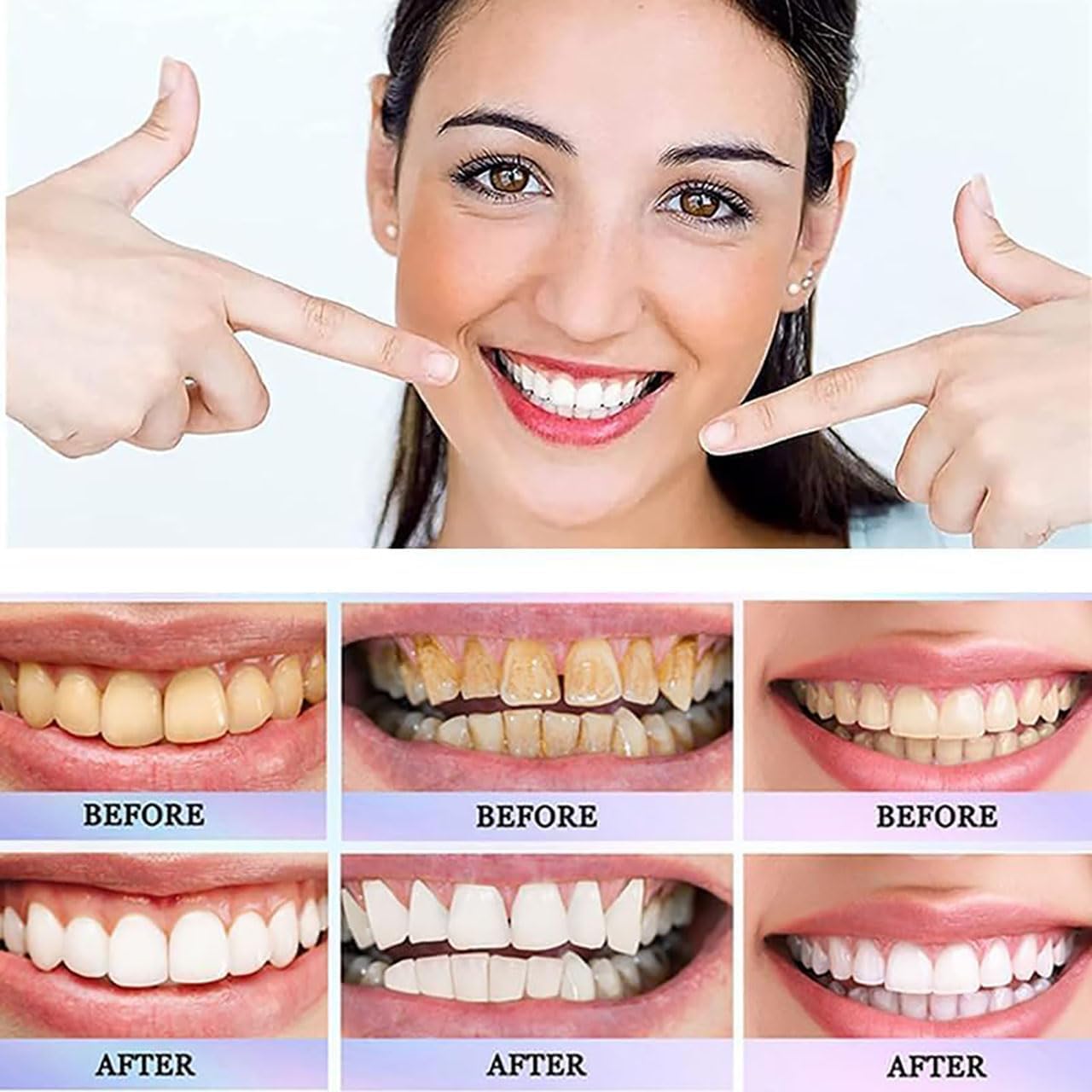 Dentifrice blanchissant à la niacinamide