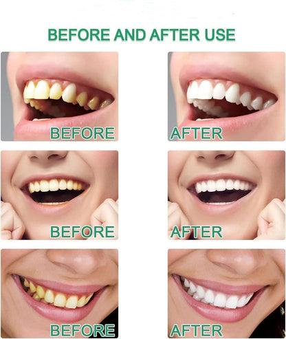 Dentifrice blanchissant à la niacinamide